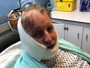 Supporting image for story: Bloxwich 'acid' attack victim 'feels lucky' to escape more serious injury after ordeal 