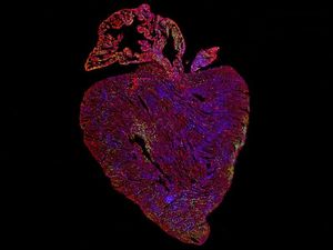 Supporting image for story: Cancer-causing gene may help treat heart disease, scientists believe