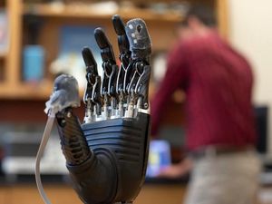 Supporting image for story: Synthetic skin enables prosthetic hand user to feel pain