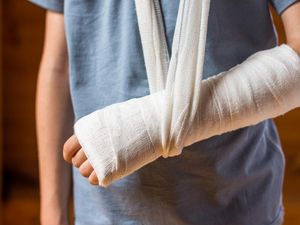 Supporting image for story: People share the most embarrassing ways they have ever injured themselves