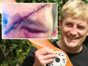 Supporting image for story: Willenhall pilot speaks of horror after being smashed in face by his own propeller