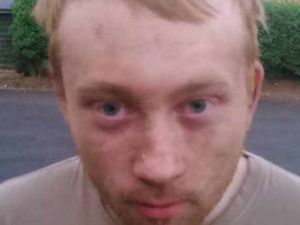 Supporting image for story: Body found in lake is missing man Alec Lightfoot