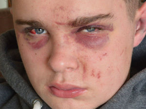 Supporting image for story: Zero tolerance pledge as five arrested over three attacks in Newtown 

