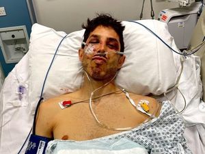 Supporting image for story: Mountain biker Gee Atherton releases video of crash that put him in hospital for two weeks