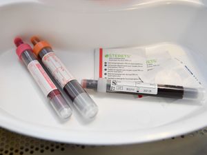 Supporting image for story: At-home hepatitis C tests identify hundreds with the virus