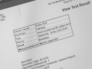 Supporting image for story: Prostate cancer blood tests ‘can lead to men being over-tested’, experts say