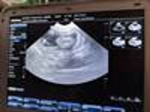 Supporting image for story: Ultrasound finds Trentham monkey is pregnant