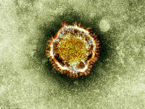 Supporting image for story: Shropshire Star comment: Full toll of coronavirus will reveal itself eventually