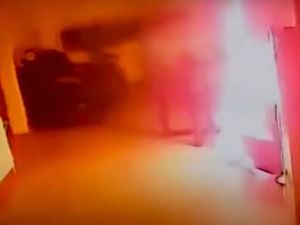 Supporting image for story: Exploding hoverboard battery sets fire to house and leaves bed-bound woman in coma