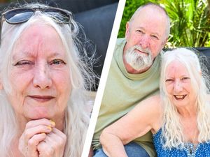 Supporting image for story: 'I fell asleep in the sun for 15 minutes in my West Midlands garden - I woke the next morning with blistered eye'