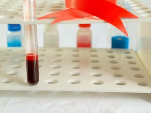 Supporting image for story: Charity hopes report will show who decided haemophiliacs were ‘expendable’