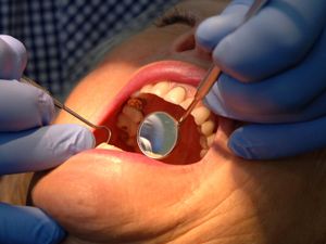 Supporting image for story: Ministers vow to boost dentistry access with 700,000 appointments rollout