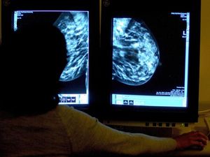 Supporting image for story: Brain-training exercises aid emotional recovery after breast cancer, study shows