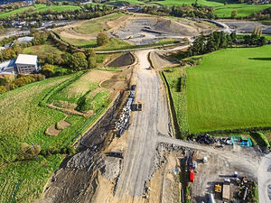 Supporting image for story: Star comment: Bypass will transform many lives