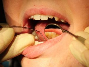 Supporting image for story: More than eight in 10 dental practices not accepting new patients, figures show