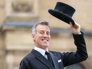 Supporting image for story: Anton Du Beke unveils hair transplant joking he wants to look like Bobby Brazier