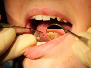 Supporting image for story: Calls for better access to NHS dental treatment for Shropshire from health watchdog
