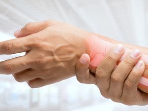 Supporting image for story: A custom-made 'bionic' bone could save arthritis patients from amputation