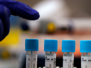 Supporting image for story: Three more coronavirus deaths at Shropshire's hospitals 