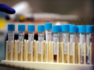 Supporting image for story: Fresh testing drive as South African variant of coronavirus identified in Black Country