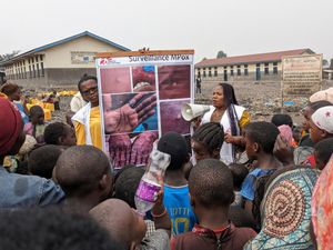 Supporting image for story: New mpox strain: What is it and what does it mean for the UK?