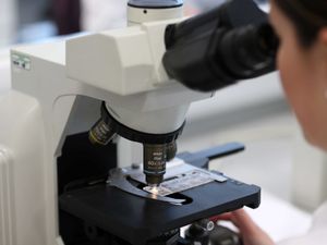 Supporting image for story: AI could predict patient’s risk of bowel cancer returning, study finds