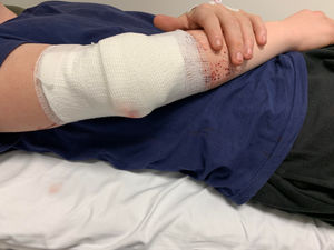 Jack was stabbed in Priory Park, in Dudley, on April 17