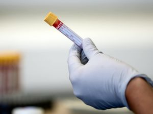 Supporting image for story: High testing levels behind jump in county's Covid rates, say health chiefs