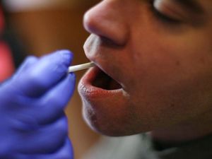 Supporting image for story: Home DNA kits could shed light on different Covid-19 impacts, scientists say