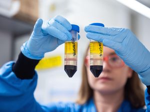 Supporting image for story: What we know so far in the still murky picture of long Covid