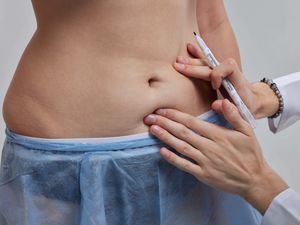 Supporting image for story: Streeting will ‘improve safety’ for Britons going abroad for cosmetic surgery