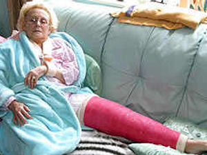 Supporting image for story: Victims tell of thug attacks