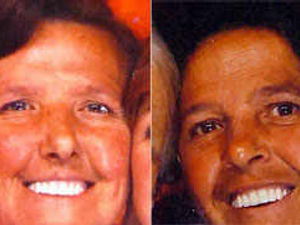 Supporting image for story: Devoted sisters die on same day