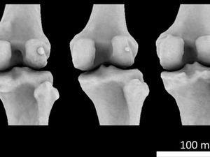 Supporting image for story: Tiny knee bone linked to osteoarthritis ‘may have helped humans walk upright’