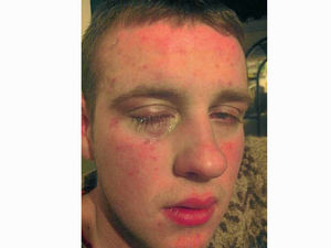 Supporting image for story: Cannock firm fined £4,000 after teenager left with acid burns