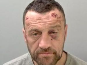 Supporting image for story: Battered face of Shrewsbury burglar revealed after breaking into family home and climbing on victim