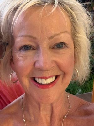 William Seymour has a rare form of epilepsy which causes constant seizures