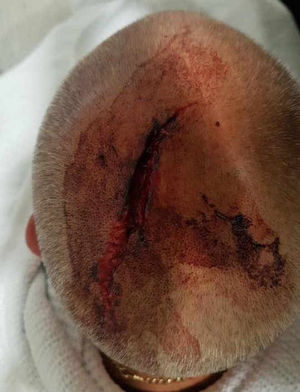 Blood was everywhere, Mr Jones said