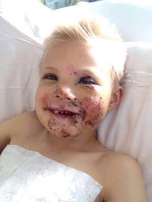 Jay’D McYoung after his accident