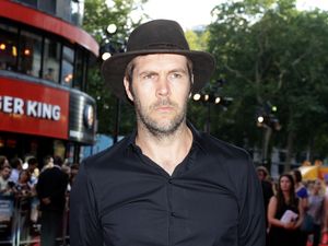 Supporting image for story: Rhod Gilbert postpones shows to have further surgery following cancer treatment