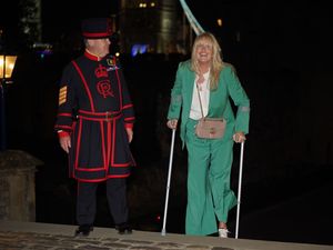 Supporting image for story: Penny Lancaster suffers knee injury while on tour with husband Sir Rod Stewart