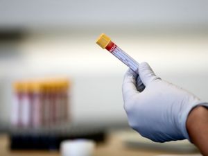Supporting image for story: Normal blood testing to resume after NHS supplies bolstered by US stocks