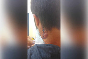Supporting image for story: 'If you don't go I will stab you' - Polish student recalls being stabbed during suspected racist attack in Telford