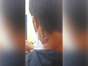 Supporting image for story: 'If you don't go I will stab you' - Polish student recalls being stabbed during suspected racist attack in Telford