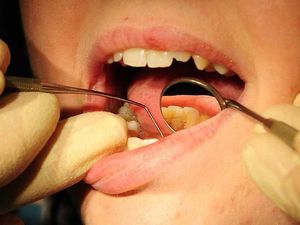 Supporting image for story: Poll: Should the NHS give more funding to dentists?