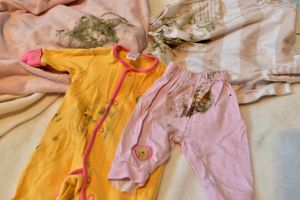 Baby clothes affected by mould