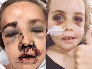 Supporting image for story: WATCH: Shropshire bike accident girl's video is an internet hit
