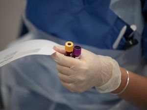 Supporting image for story: No further coronavirus deaths at Shropshire hospitals 