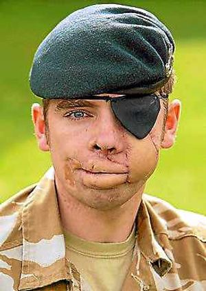 Corporal Ricky Furgusson