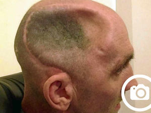 Supporting image for story: Anger over jail term for Telford attack